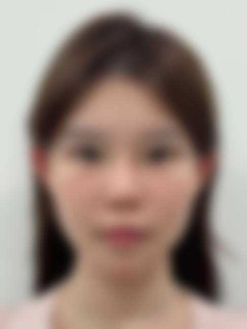 合肥至雅整形医院患者评价