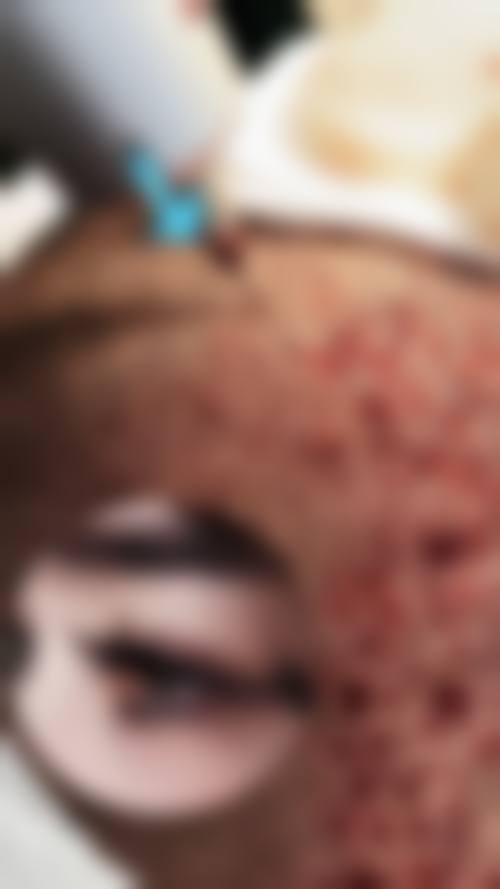 杭州星颜医疗美容整形医院核心项目