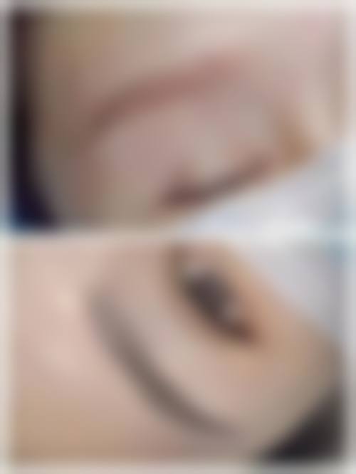 杭州星颜医疗美容整形医院患者评价