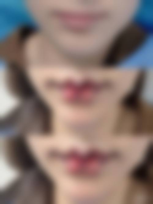 合肥至雅整形医院交通路线及预约