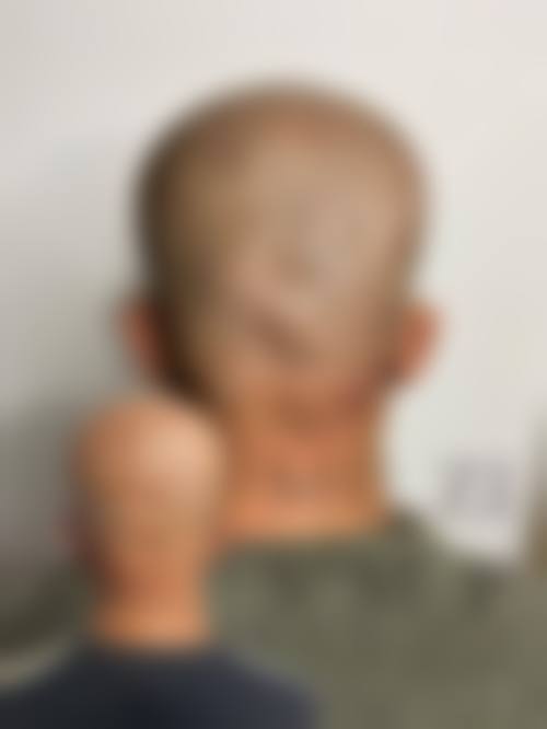 韩国牟宰成毛发移植中 心医生团队