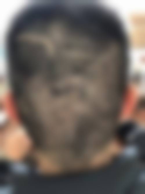 韩国牟宰成毛发移植中 心交通路线及预约