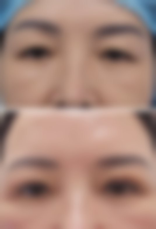 2026 广州瑞港整形医院价格参考