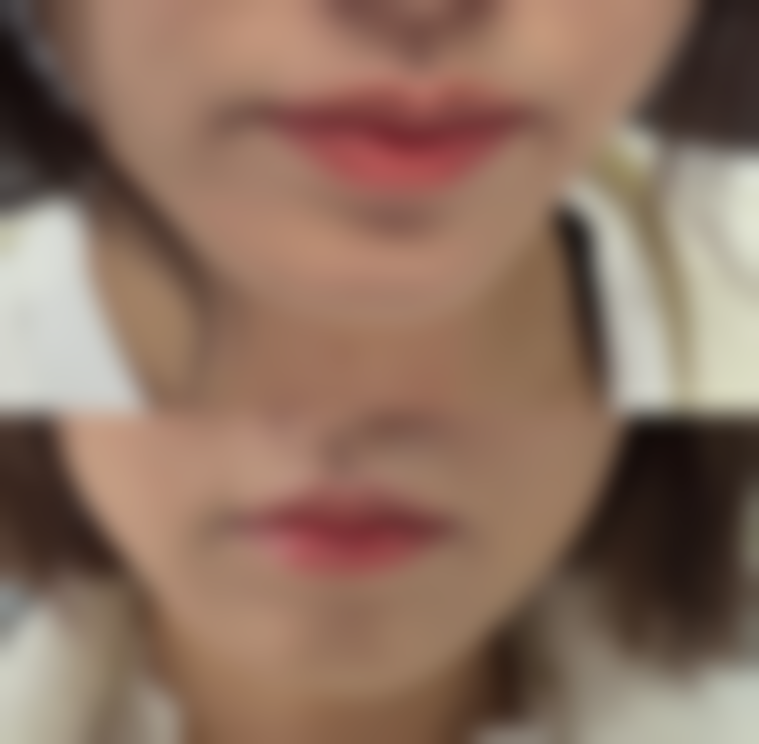 沈阳陆素芝整形医疗美容诊所患者评价