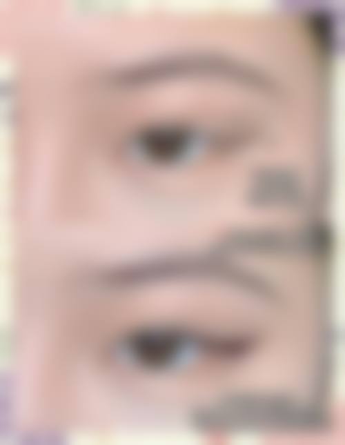 连云港美缔整形交通路线及预约