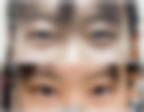 连云港美缔整形患者评价