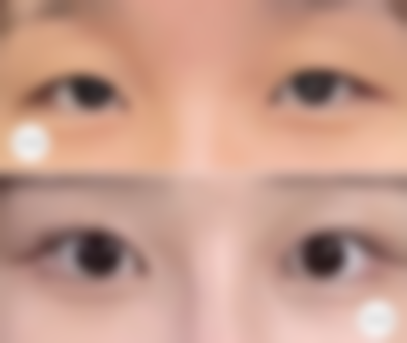 合肥爱春整形医院核心项目