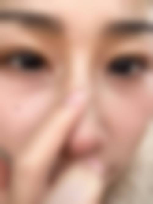 潍坊杏林优美医疗美容门诊部患者评价