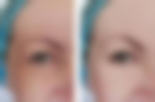 海南梦妮幻整形美容机构患者评价