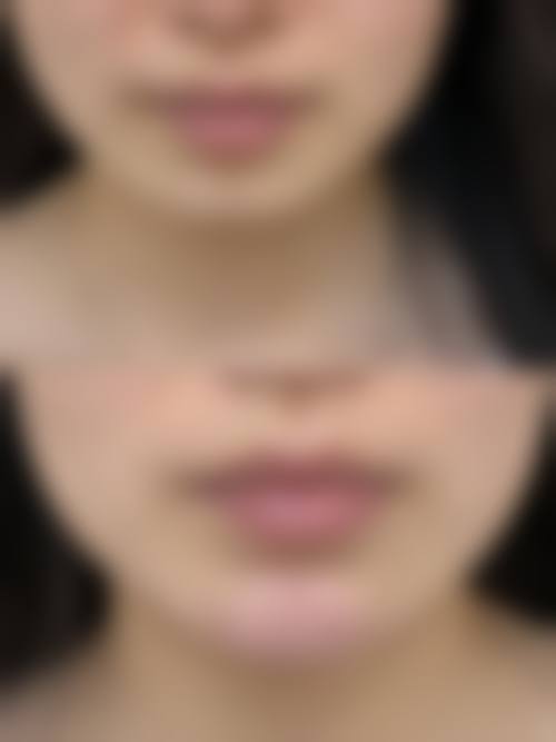 遂川星面孔整形医院患者评价