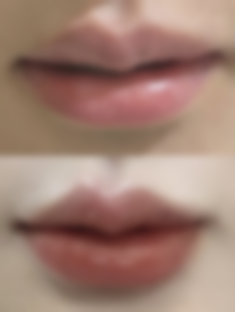 济南第四人民医院烧伤整形外科真实患者评价