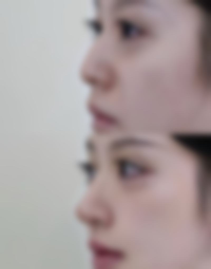 张文琪患者评价