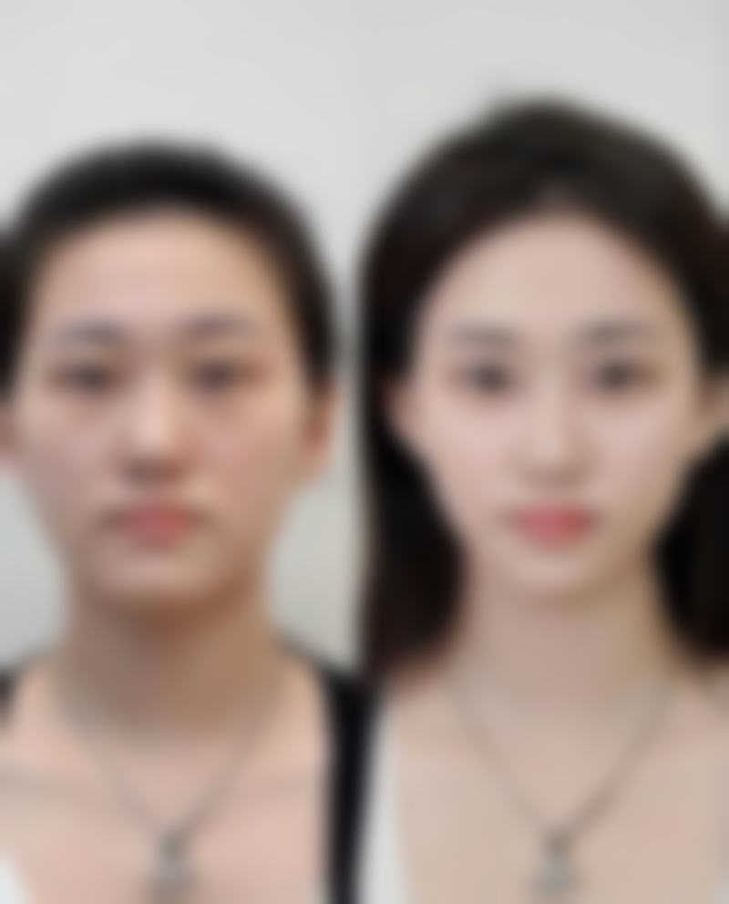 济南第四人民医院烧伤整形外科项目价格参考