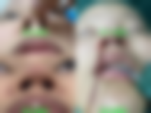 宁波星面孔乔丽整形医院真实患者评价