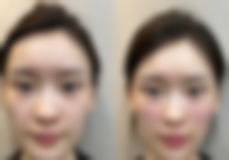 邢丽君擅长项目列表