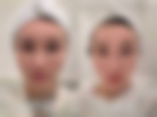 2026 北京汇美医疗美容医院项目价格参考