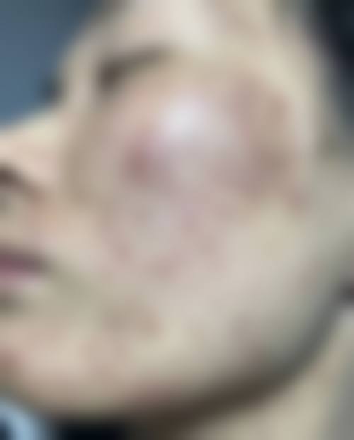 长春润堂林氏皮肤门诊部真实患者评价