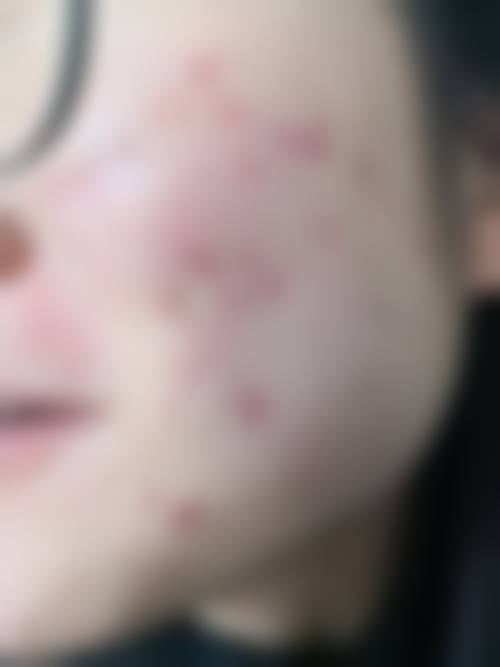 长春润堂林氏皮肤门诊部交通路线及预约方式