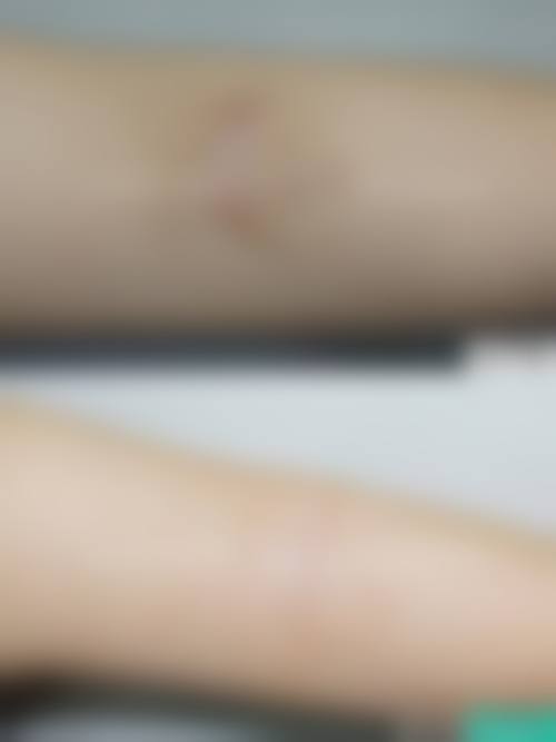 长春润堂林氏皮肤门诊部擅长项目有哪些？