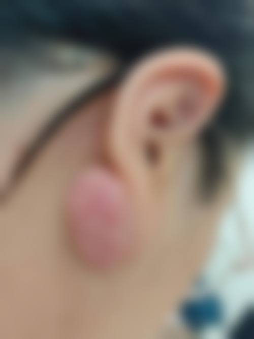 河北友爱医院整形美容科真实患者评价