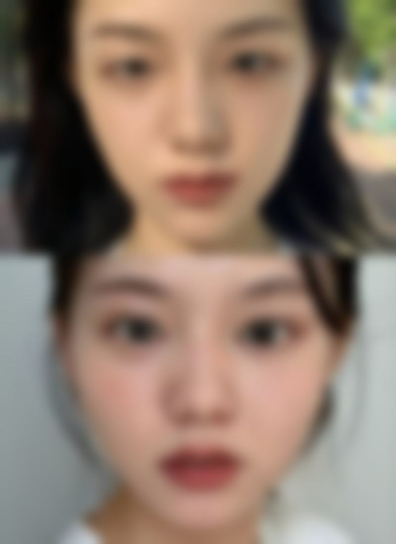 吉林大学第二医院擅长项目有哪些？