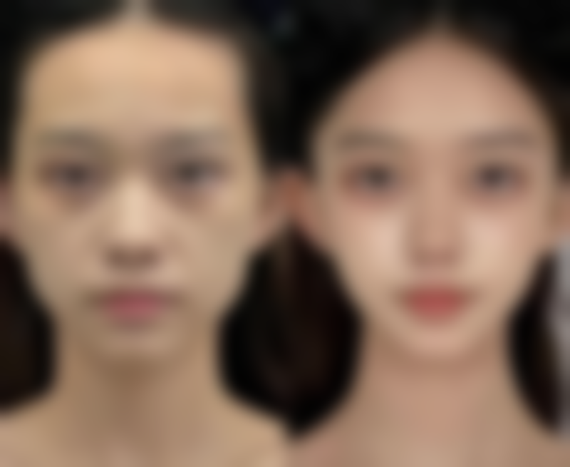 李珑擅长项目列表