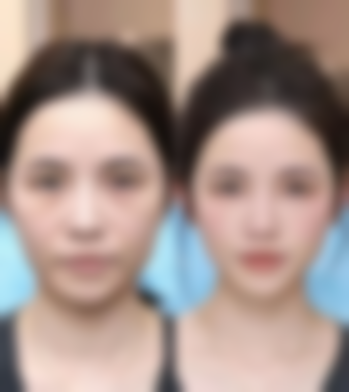 石家庄晟代美整形医院擅长项目有哪些？