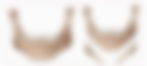 陈小剑患者评价