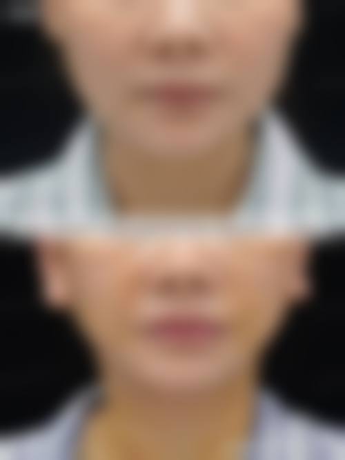 厦门思明华美医疗美容门诊部擅长项目有哪些？