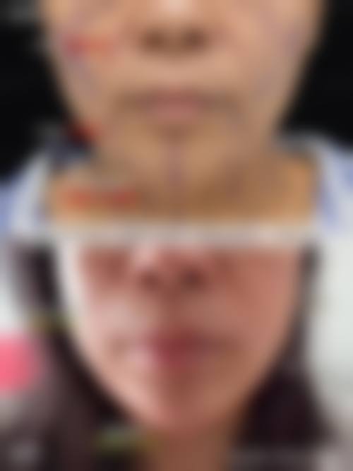 厦门思明华美医疗美容门诊部交通路线及预约方式