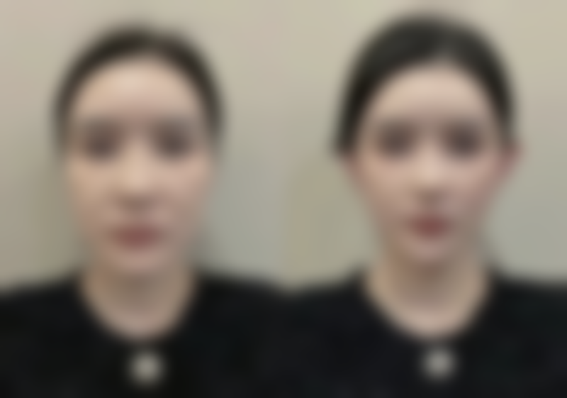 2026 成都锦江今妃医学美容诊所项目价格参考