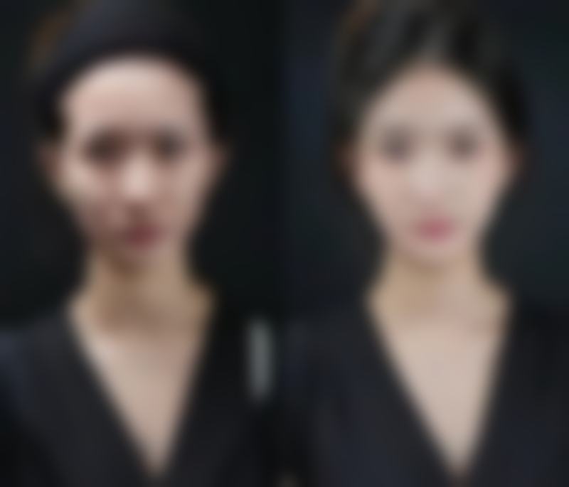 2026厦门呈美医疗美容诊所项目价格参考