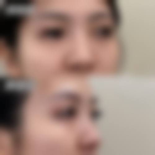 惠州市惠阳区人民医院整形烧伤外科擅长项目有哪些？