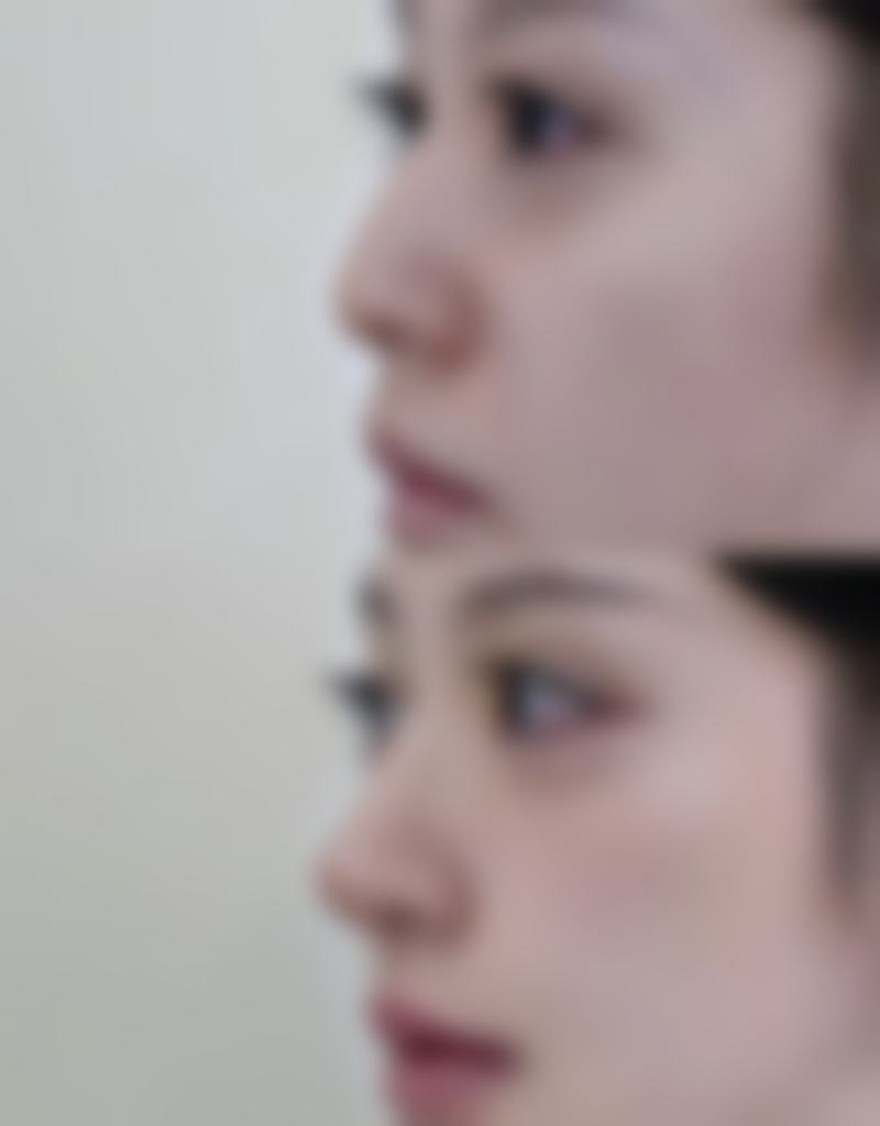 衢州苏杭医疗美容诊所真实患者评价