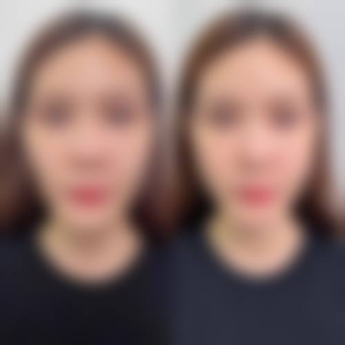 长沙叶子医疗美容门诊部擅长项目有哪些？
