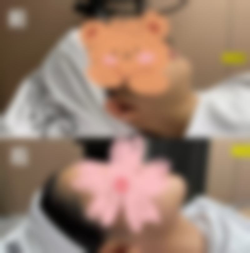 沈阳瑞博整形真实患者评价