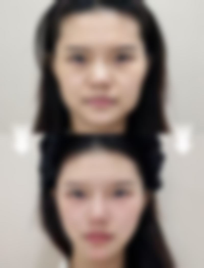 长沙叶子医疗美容门诊部真实患者评价