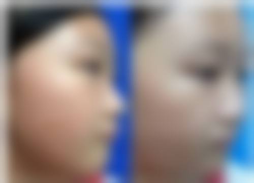 2026 嘉峪关市红十字长城医院整形美容科项目价格参考