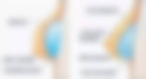 刘月明患者评价