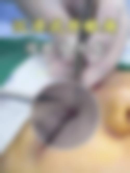 金华晶美医疗美容门诊部真实患者评价