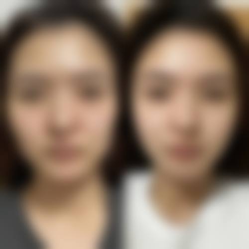 泉州泉港区卫生防疫站医学美容医院交通路线及预约方式