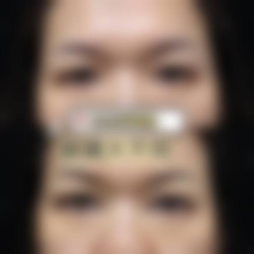 资阳韩美医学整形美容门诊部真实患者评价