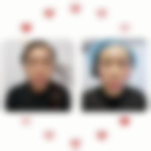 烟台IB整形美容医院擅长项目有哪些？