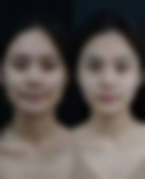 西安新城晶肤医学美容诊所擅长项目有哪些？