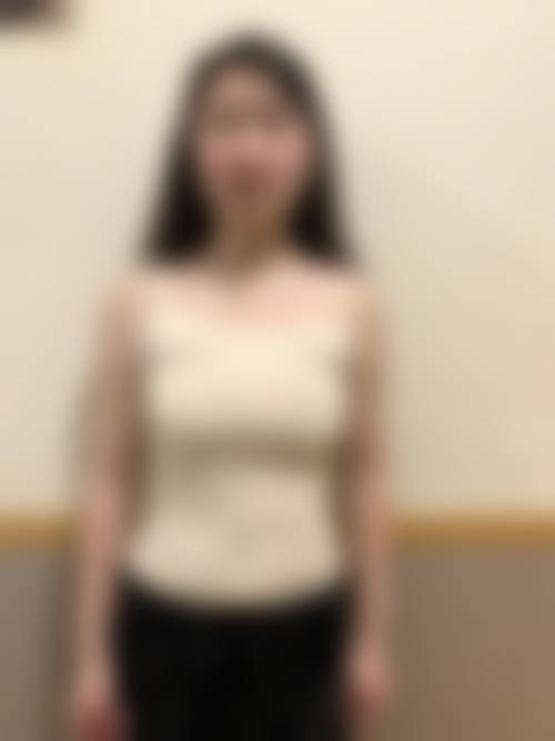 莆田福仁整形医院真实患者评价