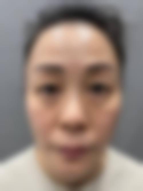 【杭州聚美医疗美容门诊部擅长项目有哪些？】