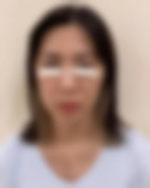 【杭州聚美医疗美容门诊部真实患者评价】