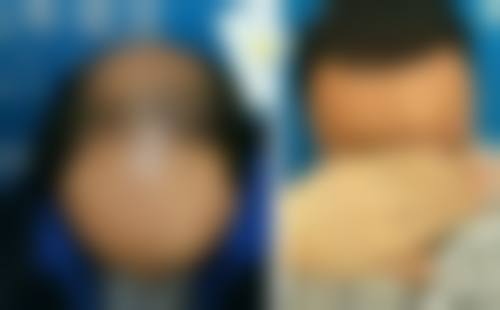 【2026东营医联美医疗美容诊所项目价格参考】