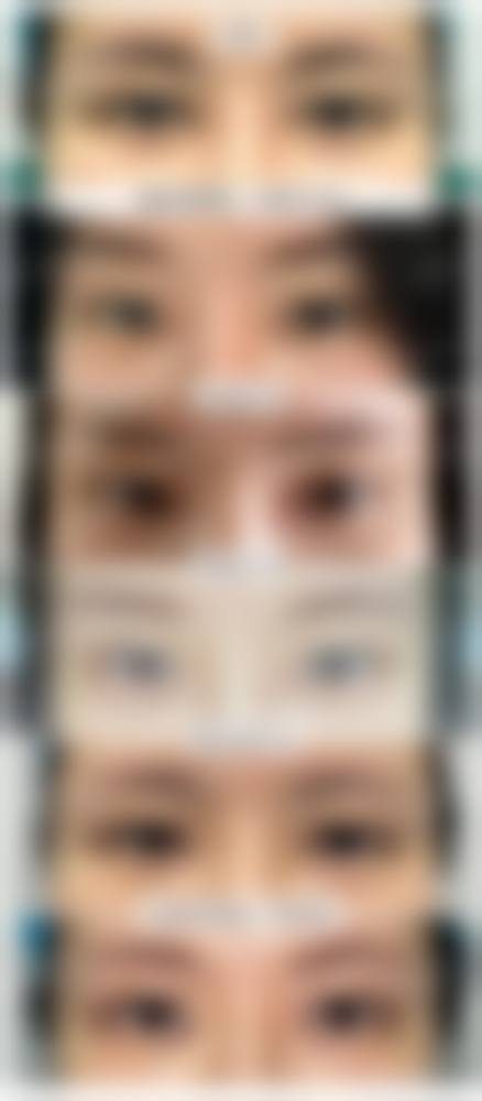 【太原艺美臻妍整形医院真实患者评价】