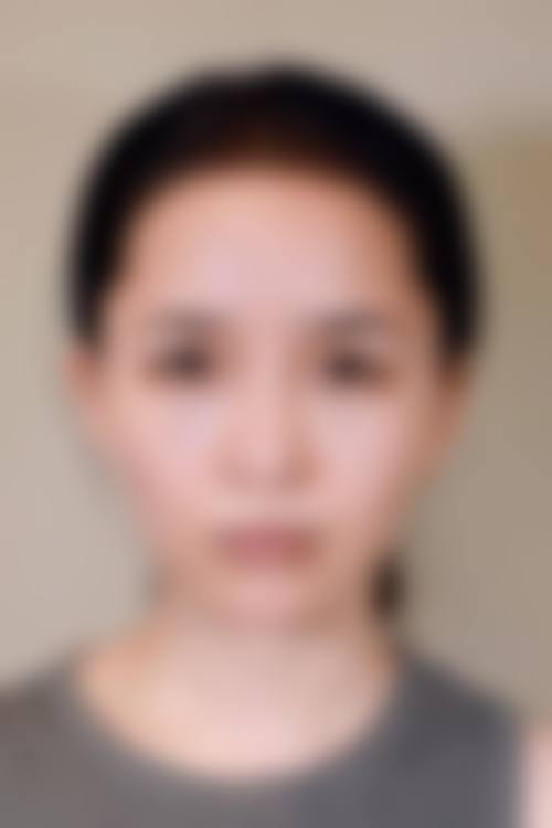 【2026太原艺美臻妍整形医院项目价格参考】